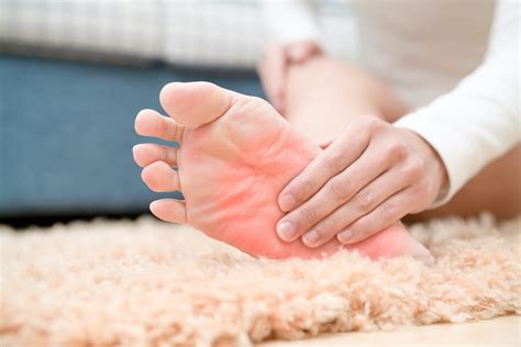 Psoriatic Arthritis Feet