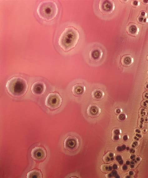 Coliform bacteria | Characteristics & Examples | Britannica