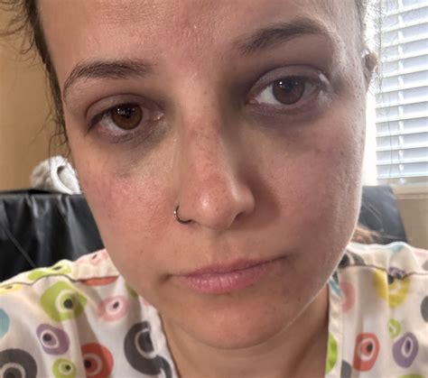 Woman "Savagely Beaten" at RÜFÜS DU SOL Rose Bowl Concert Sues Venue ...