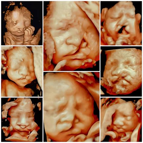 The utilization of artificial intelligence in enhancing 3D/4D ...