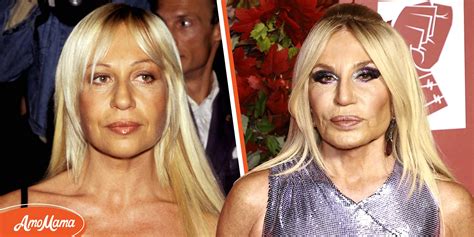 Experts Believe Donatella Versace Had Several Plastic Surgeries & She Once Confirmed She Got ...