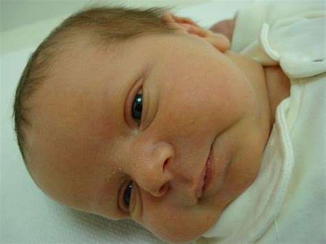Yellow eye boogers in newborns