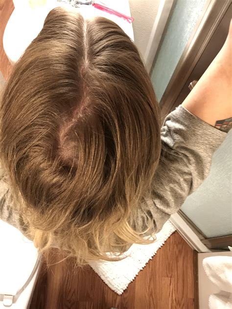 Why Do I Have A Cowlick In The Back Of My Head - POPULAR MEN'S HAIRCUTS