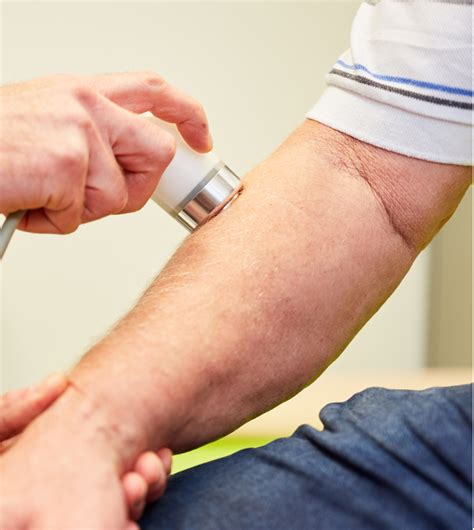 Tennis Elbow | Golfer's Elbow | DeQuervain's | Perfect Therapy