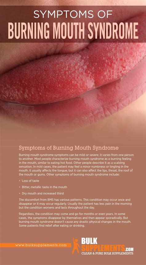 Treatment For Burning Tongue Syndrome