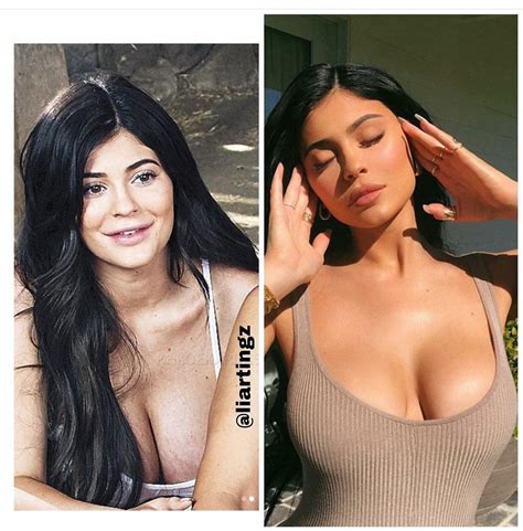 Nice to know she has stretch marks on her boobs just like the rest of ...