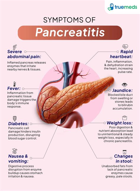 Pancreatitis: Causes, Symptoms, Treatment & Prevention Tips