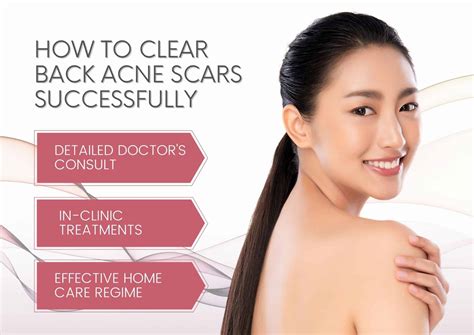 Acne Scars Removal Home Natural Remedies