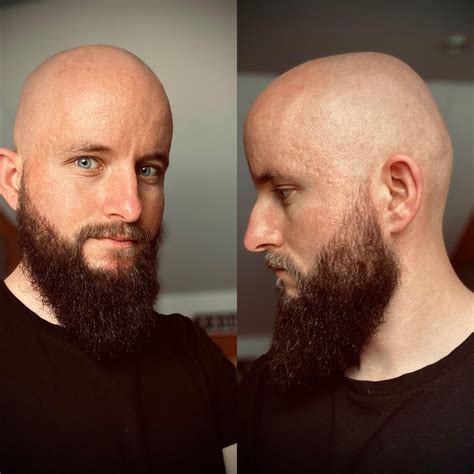 Fresh shave and beard fade. Not sure if I should grow my beard longer ...