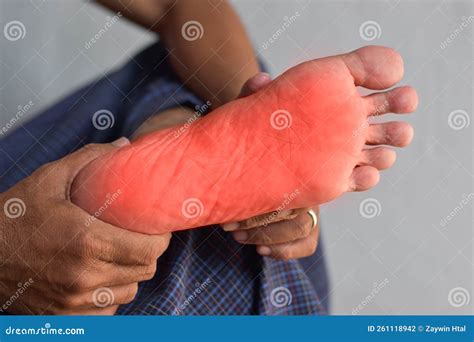 Tingling and Burning Sensation in Foot of Asian Man. Foot Pain. Sensory Neuropathy Problems ...