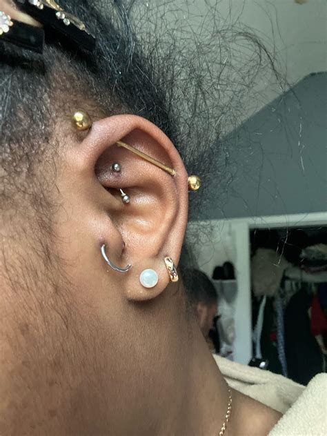 keloids??? : r/piercing