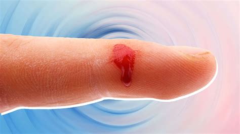 Can You Get Tetanus From A Razor Cut at Erin Love blog