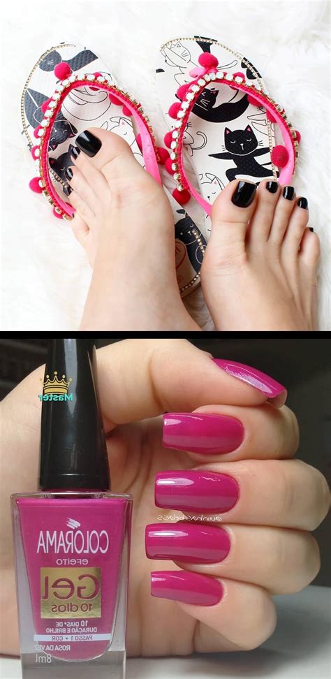 Onychomycosis Icd 10