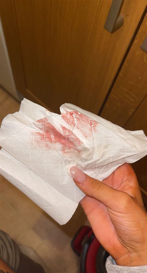 What Does Implantation Bleeding Look Like On Toilet Paper How To