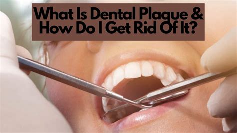 Dental Plaque