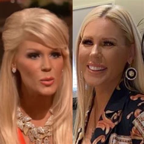 Gretchen Rossi Before And After