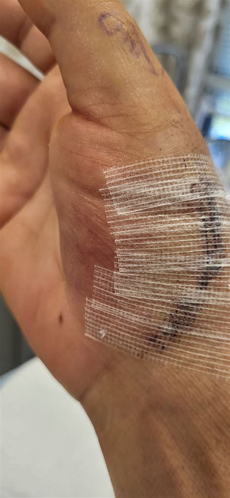 Post-Op Physical Therapy Treatments — CoreMovement Physical Therapy ...