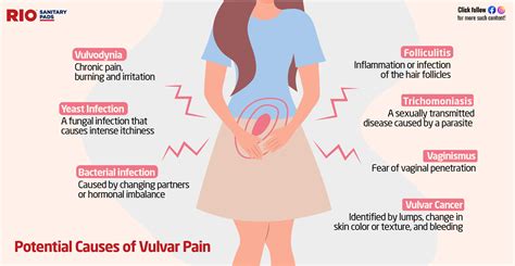 Vulvodynia Symptoms