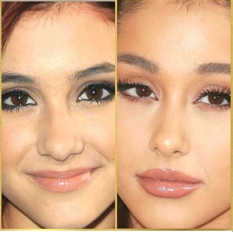 Ariana Grande | Celebrity plastic surgery, Nose plastic surgery ...