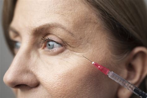 From Injection to Results: How Long Does Botox Last?