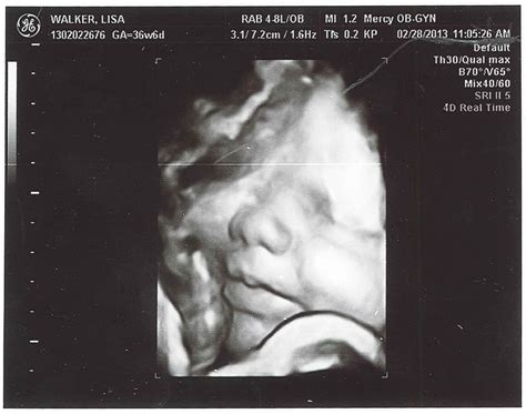 Pages From the Pursuit: Photos: Baby Boy Ultrasound at 37 weeks
