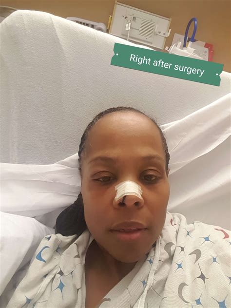 Leaking Brain Fluid Through Nose