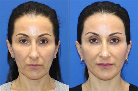 All About Anthony Ramos' Parents, Mildred Ramos and Mario Martinez