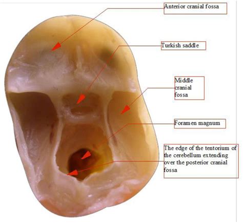 Anterior Cranial Fossa “🧠 A Journey Through The Cranial Fossae!
