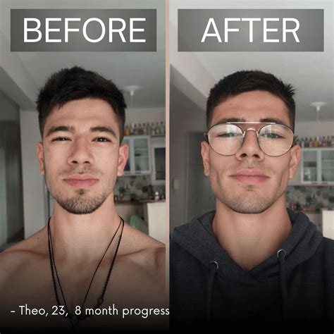 Do I Have Hunter Eyes? A Comprehensive Guide to Understanding Your Eye ...