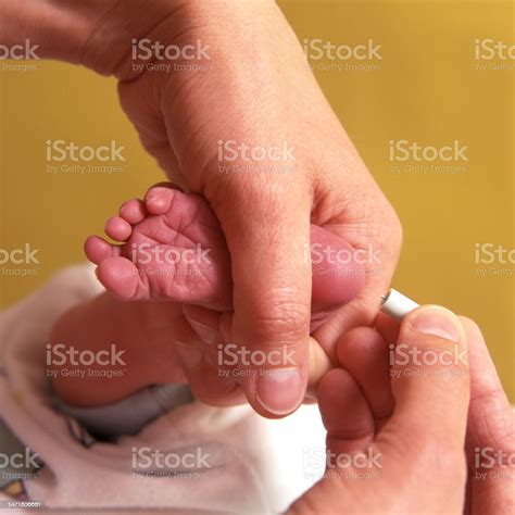 Blood Is Taken From A Twoweekold Baby To Test For Phenylketonuria Stock ...
