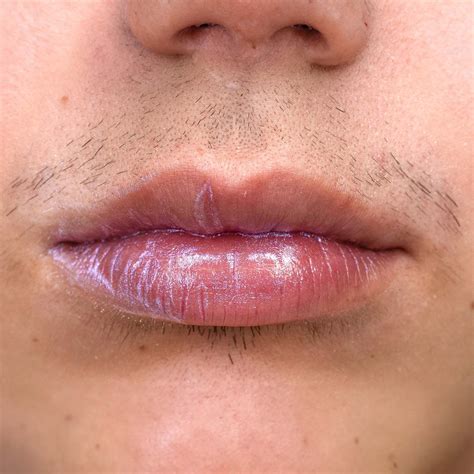 Get to the Root of PCOS Facial Hair – RoseSkinCo.