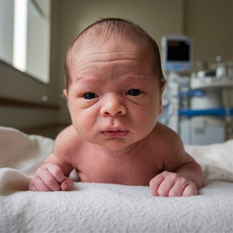What Are the Signs of Down’s Syndrome in Babies?
