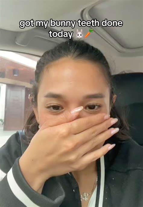 People With Rabbit Teeth