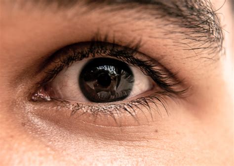 Home Remedies to Cure Dark Eyelids - Fonsly