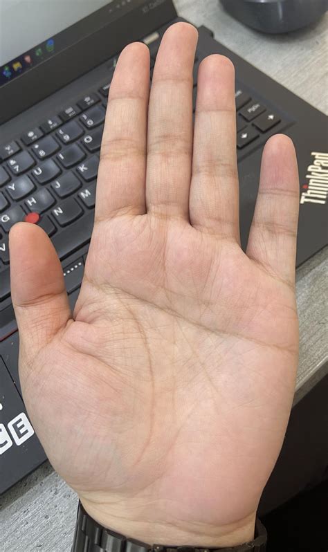 Single Palmar Crease on both palms - anything unusual? Wondering about ...