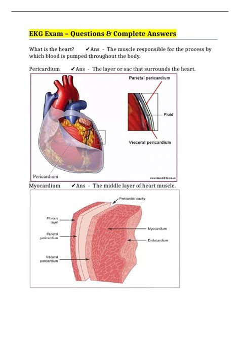 EKG Exam - Questions & Complete Answers - EKG Certification - Stuvia US