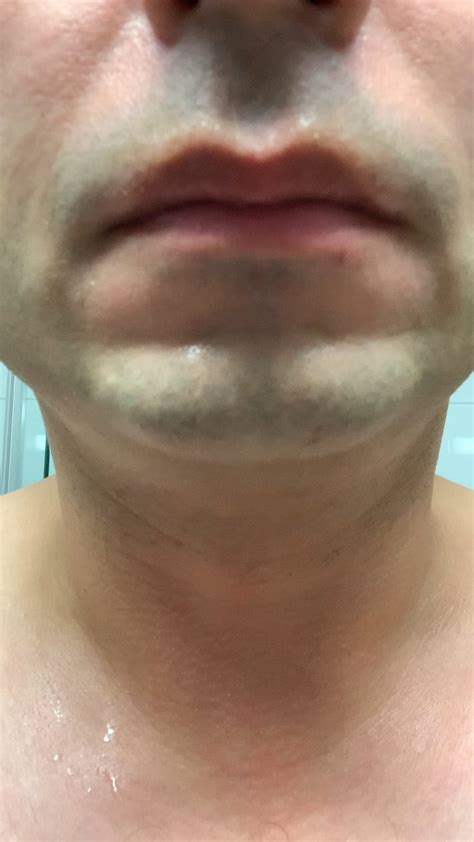 Lower lip twitching : r/BFS