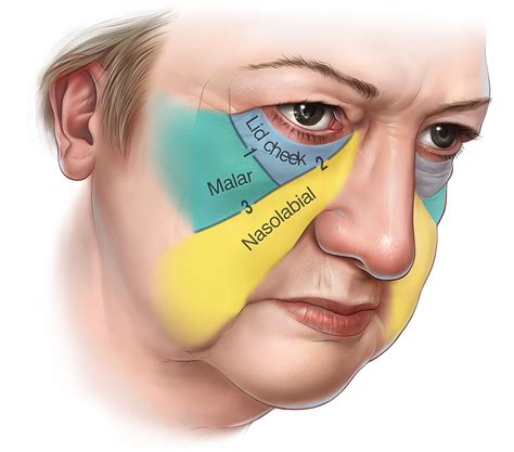 Pain In Cheek Bone Under Eye at Ann Feathers blog