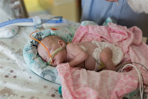 Baby Paisley Update | Premie Baby Born at 26 Weeks 4 Days — Michelle ...