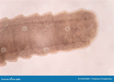 Aquarium Fish Tapeworm Symptoms at Heather Phillips blog