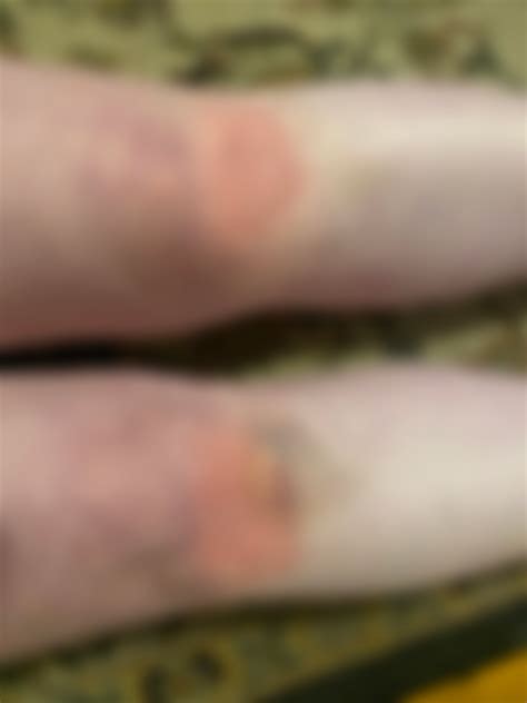 My punishment: kneel on rice for 15 minutes. : r/bdsm