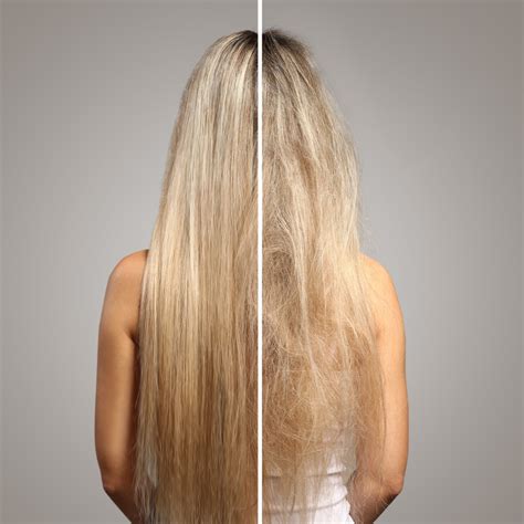 How to Repair and Treat Winter Hair Damage | Zenagen Hair Loss Treatment