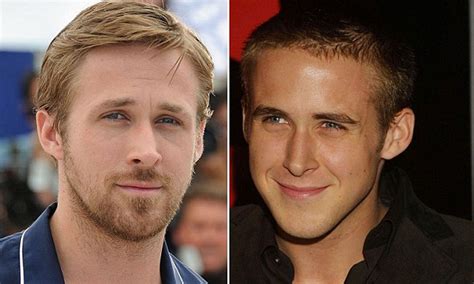Ryan Gosling Rinoplastica Ryan Gosling Plastic Surgery: Subtle