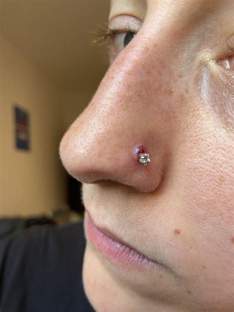 Nose Piercing Bump Help at Elaine Baltimore blog