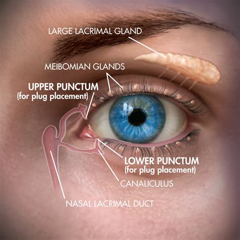 Punctal Plugs | Discover Dry Eye Relief Today — Sunshine Optometry