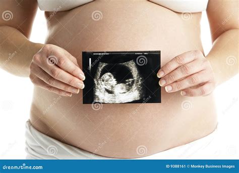 Detail of Pregnant Woman Holding Ultrasound Scan Stock Image - Image of ...