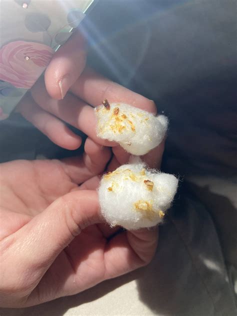 I should probably clean my ears more often. Pickings after using Hydrogen peroxide. : r/earwax