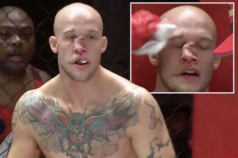 Ufc Broken Nose Dustin Poirier Faces Indefinite Medical Suspension