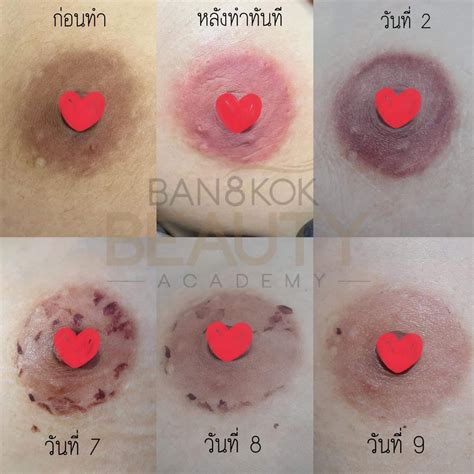 AREOLA1 | Bangkok Beauty Academy No.1 Microblading in Thailand