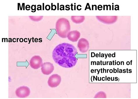 MCH Blood Test - Normal Range, Low and High MCH